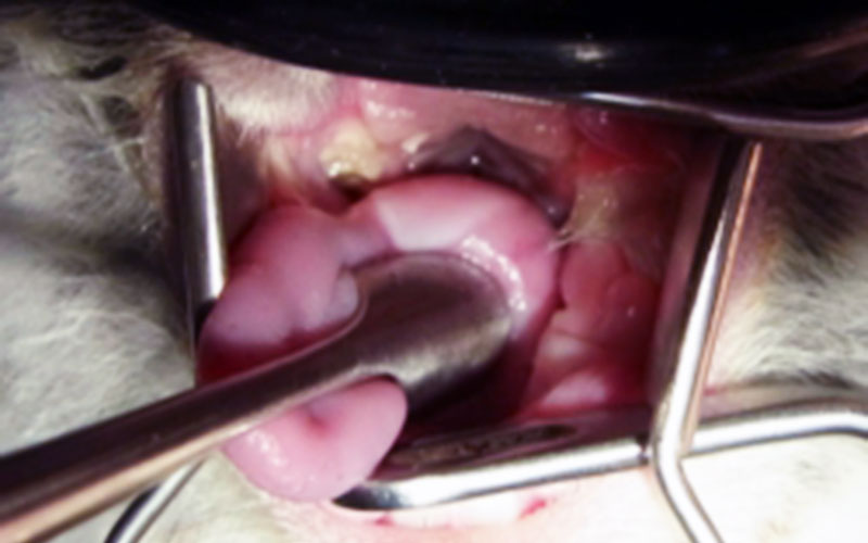 臼歯の不正咬合 施術後1