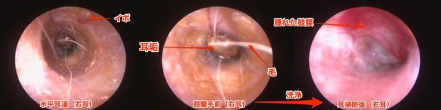 大きな耳垢 耳垢栓塞 なかなか治らない犬の外耳炎は 耳の奥深くに原因があるかもしれません 宮城県 仙台市のアレックス動物病院